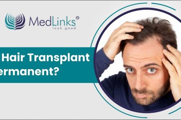 Best Hair Transplant In Gurgaon - India